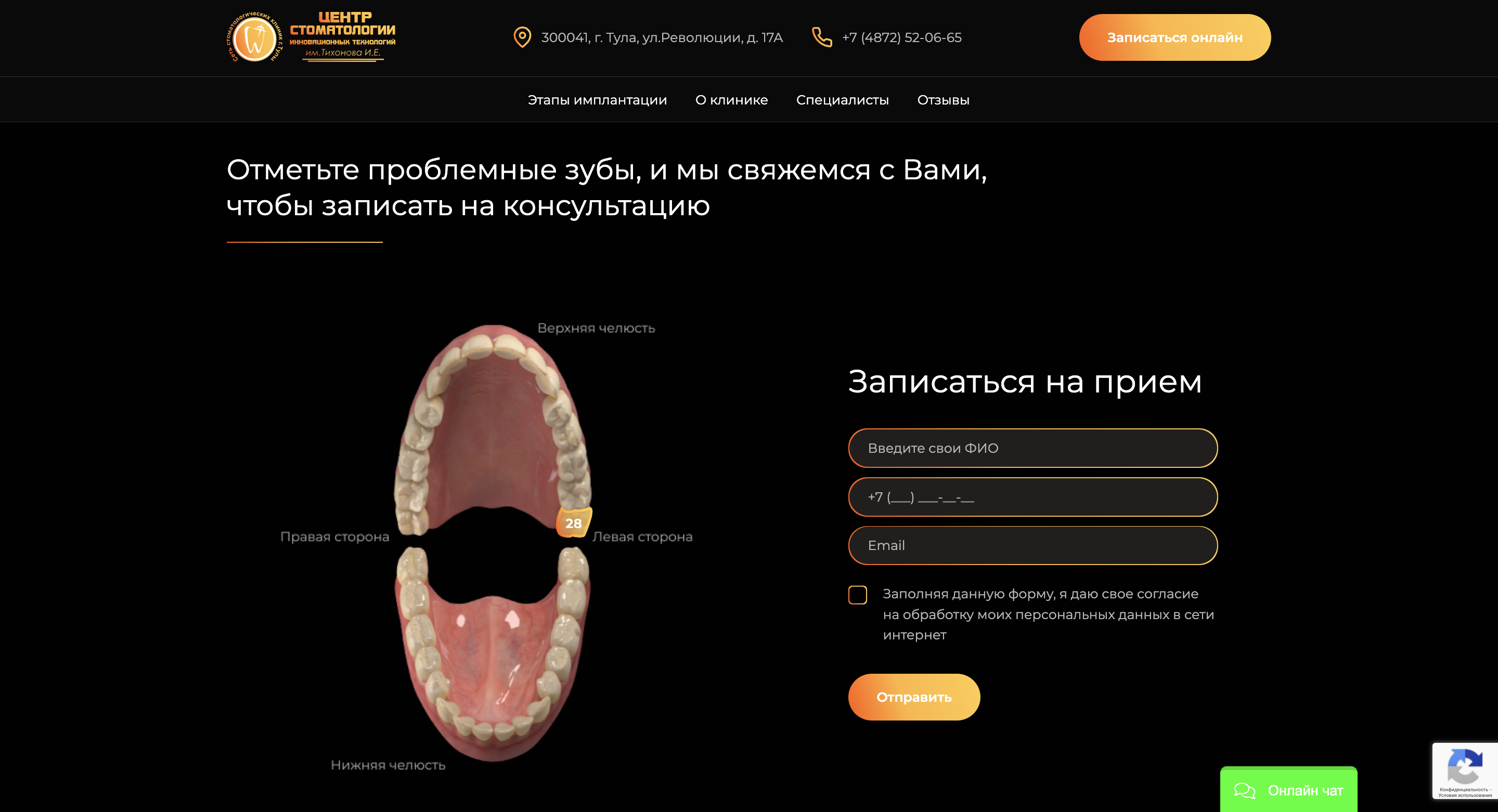 implantnobel.tuladent.ru / Форма записи на прием